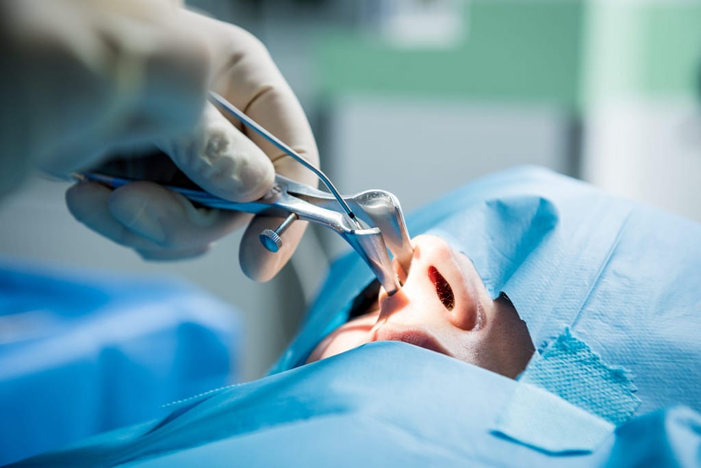 Chirurgie de la face
